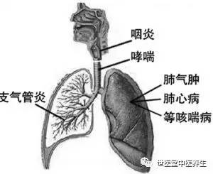 奇迹之旅见证友情力量，支气管扩张最新疗法揭秘