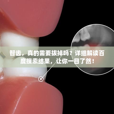 智齿，真的需要拔掉吗？详细解读百度搜索结果，让你一目了然！