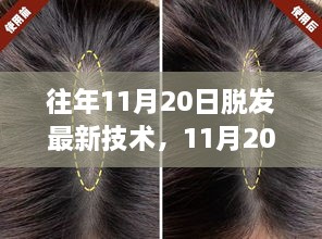 11月20日，脱发治疗技术革新里程碑，最新脱发治疗技术揭秘