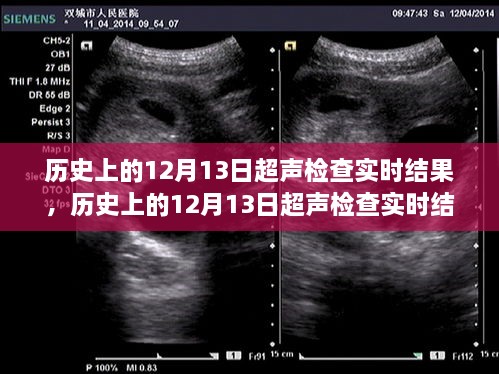 技术发展与医学进步，历史上的12月13日超声检查实时结果回顾