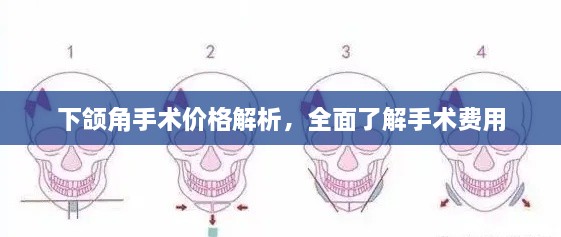 下颌角手术价格解析，全面了解手术费用