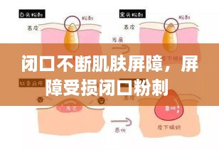 闭口不断肌肤屏障，屏障受损闭口粉刺 